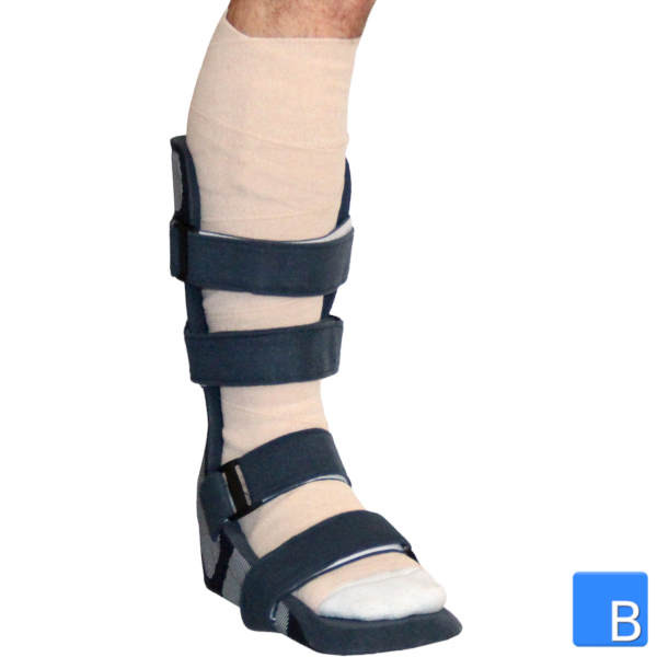 SplintPod Stripes Fusslagerungsschiene Anwendung mit einem Verband