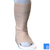 SplintPod Lagerungsschiene Fixation mit Verband
